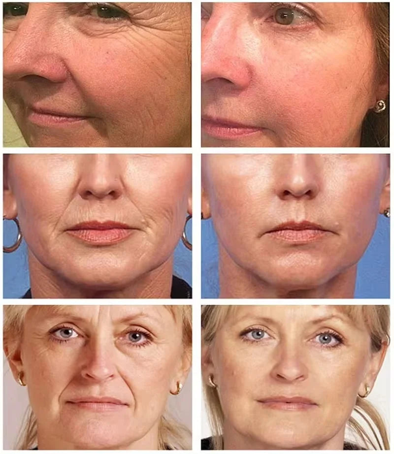 Retinol Wrinkle Remover Face Serum-1