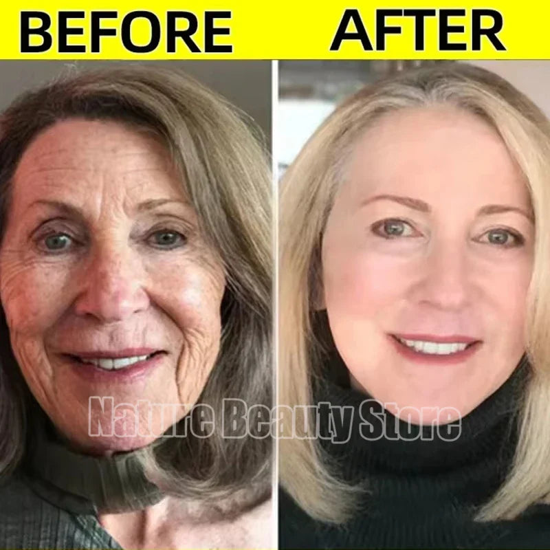 Retinol Wrinkle Remover Face Serum-3